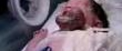 طفل يولد وقلبه خارج جسمه طفل يولد وقلبه خارج جسمه
